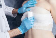 breast reduction surgery